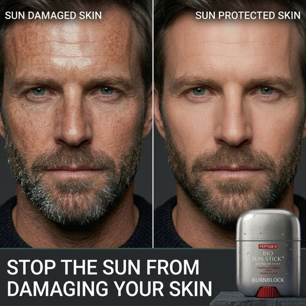 SUN DAMAGE IS REAL